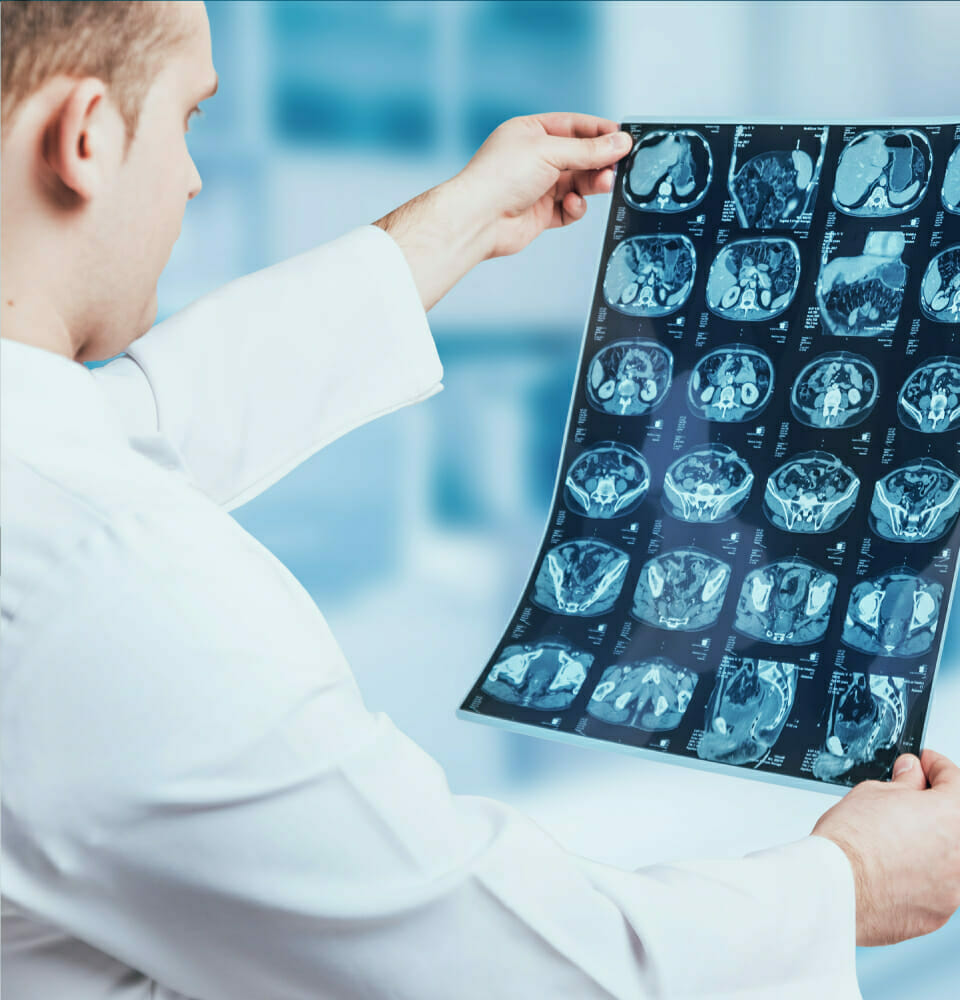 3T-MRI-Image01-960x1000