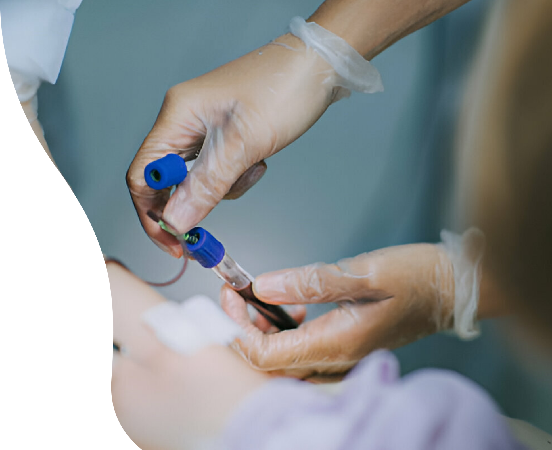 blood test private clinic London UME Health