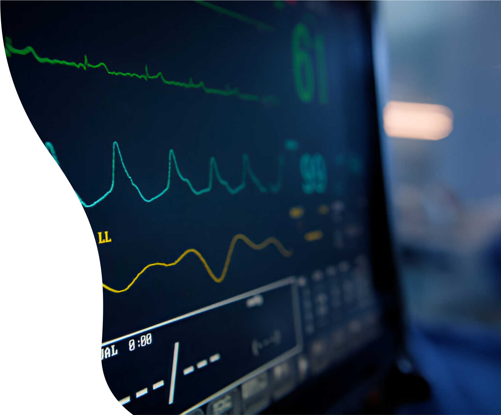 ECG Hero