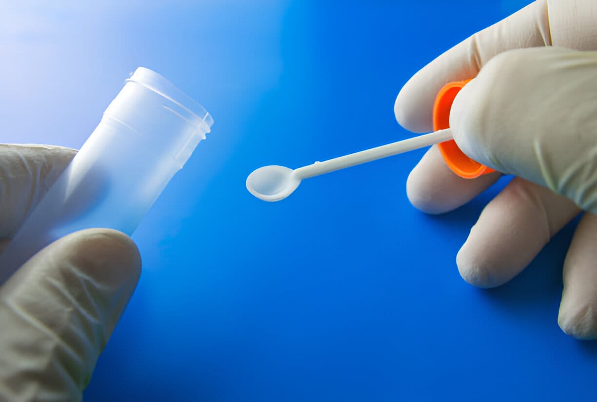 Stool and Urine Tests
