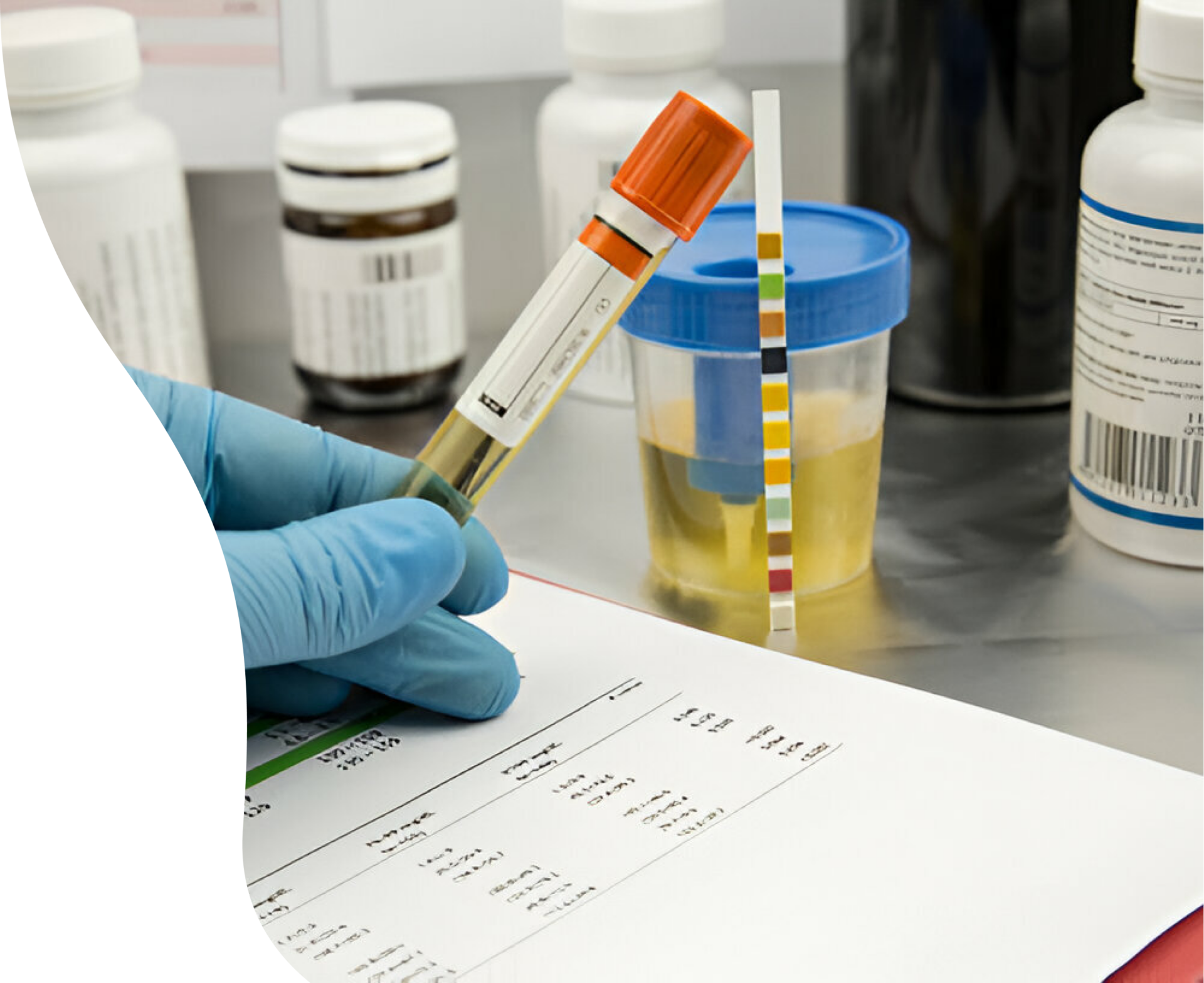 Urine tests hero